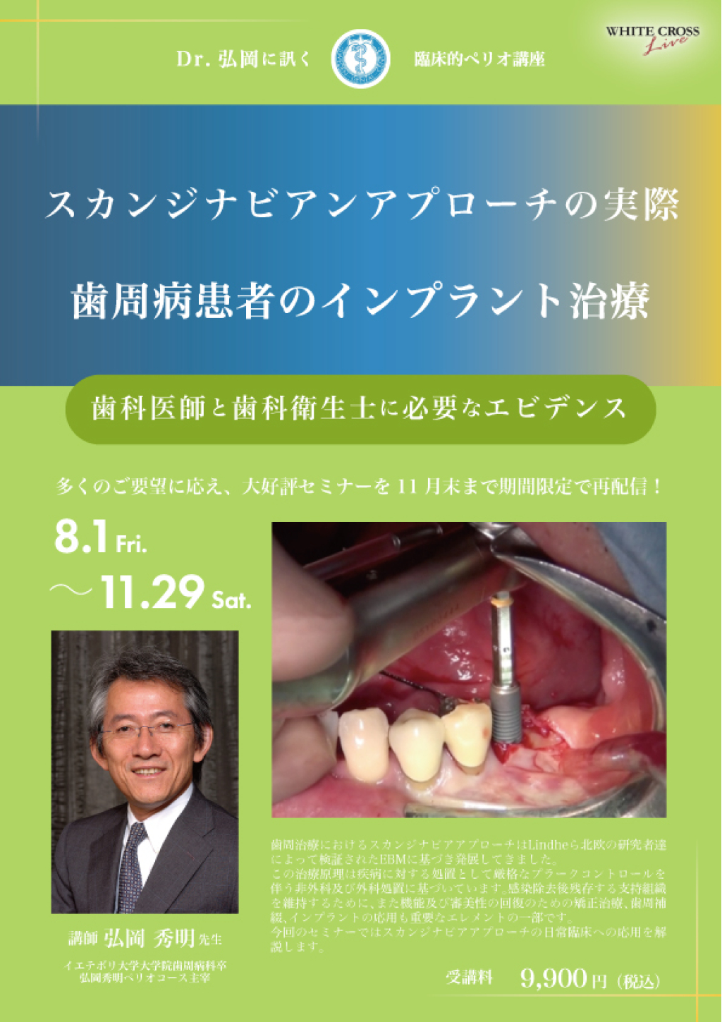 【裁断済】Dr.弘岡に訊く臨床的ペリオ講座 スカンジナビアンアプローチの実践 Dr.弘岡に訊く臨床的ペリオ講座 スカンジナビアンアプローチの