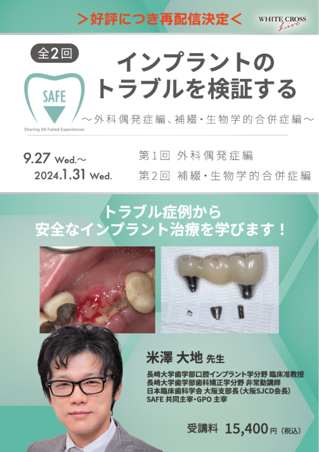 誰もが遭遇するインプラント補綴の合併症(中古品) 誰もが遭遇 