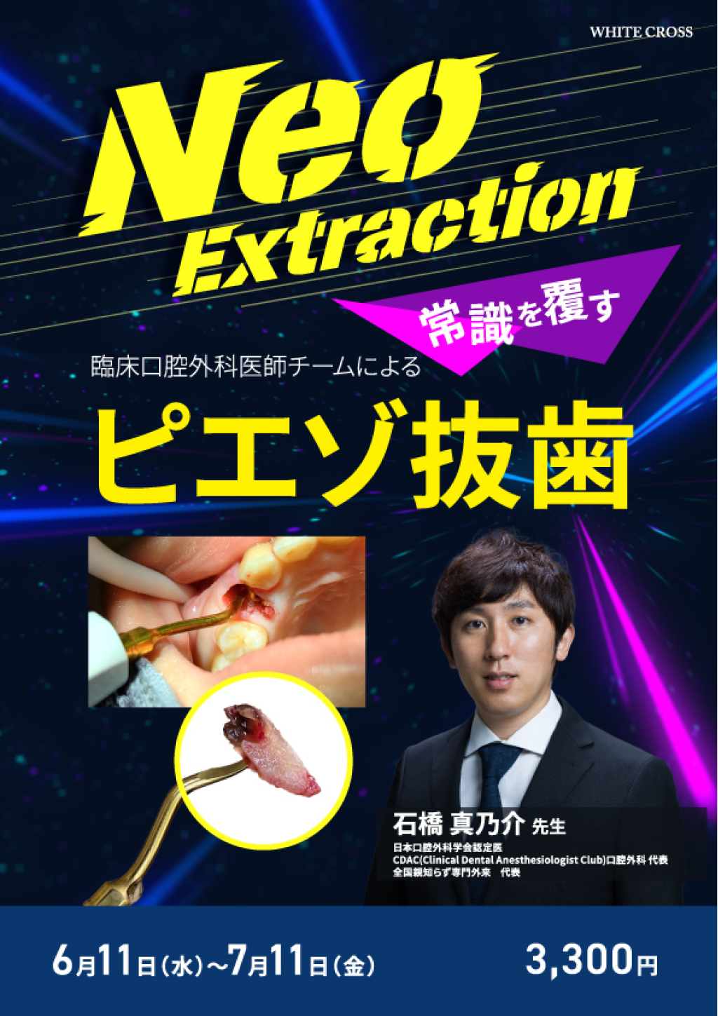 Neo Extraction 臨床口腔外科医師チームによる常識を覆すピエゾ抜歯の画像です。