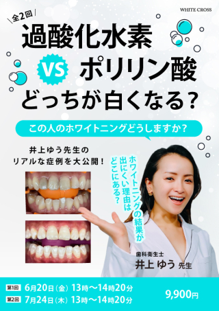 ［録画配信］過酸化水素 vs ポリリン酸 どっちが白くなる？〜この人のホワイトニングどうしますか？〜の画像です。