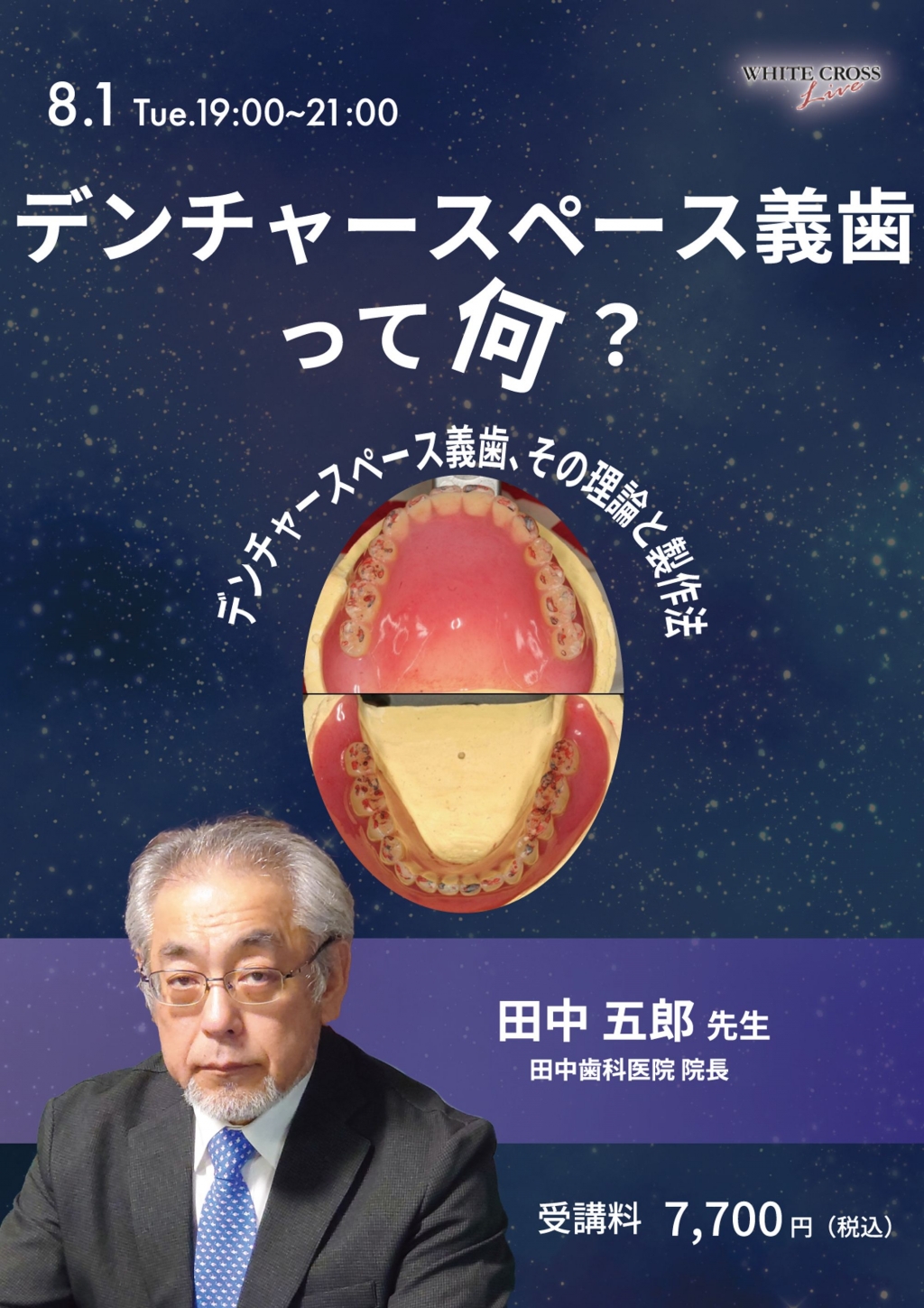 録画配信］デンチャースペース義歯って何？ | WHITE CROSS