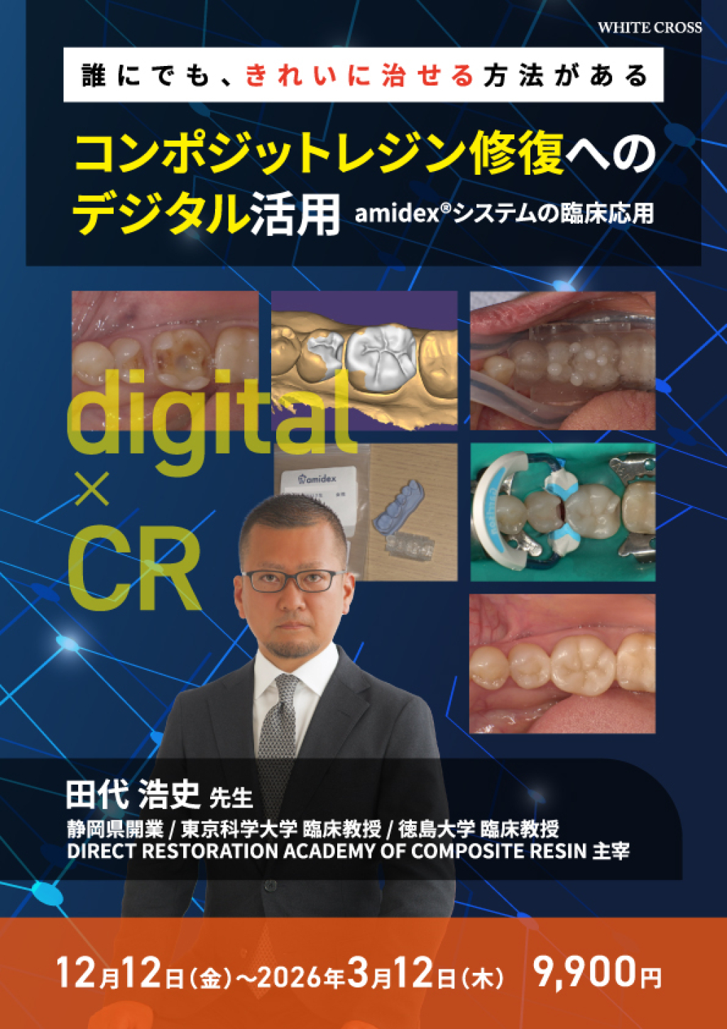 コンポジットレジン修復へのデジタル活用 | WHITE CROSS