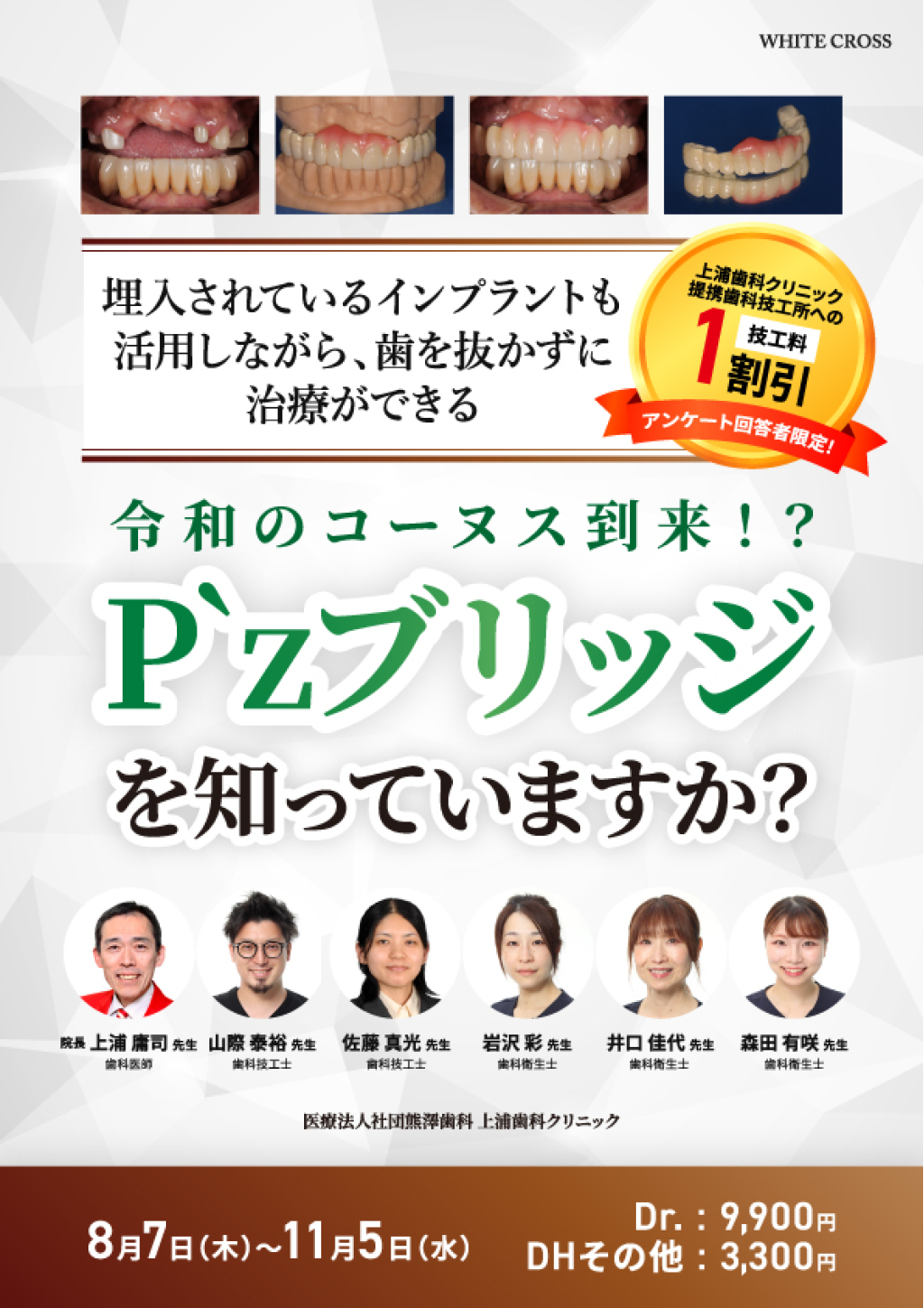 令和のコーヌス到来！？P'z ブリッジを知っていますか？ | WHITE CROSS