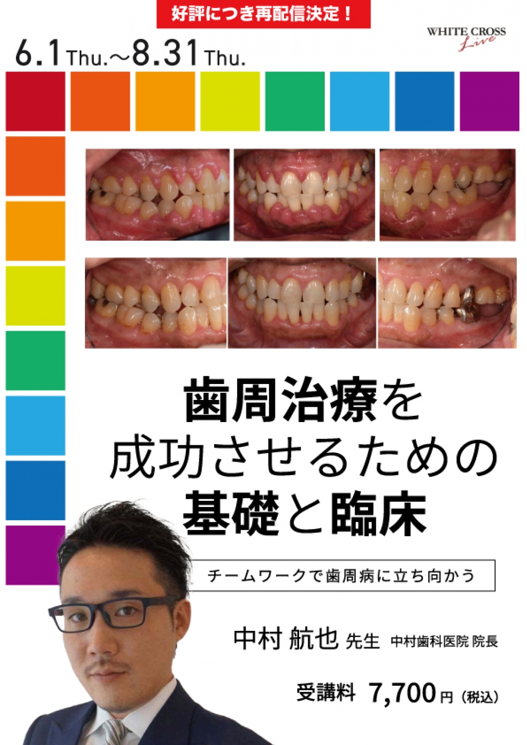 歯周病治療の臨床 | |本 鴫原, 歯周 VOD］歯周治療