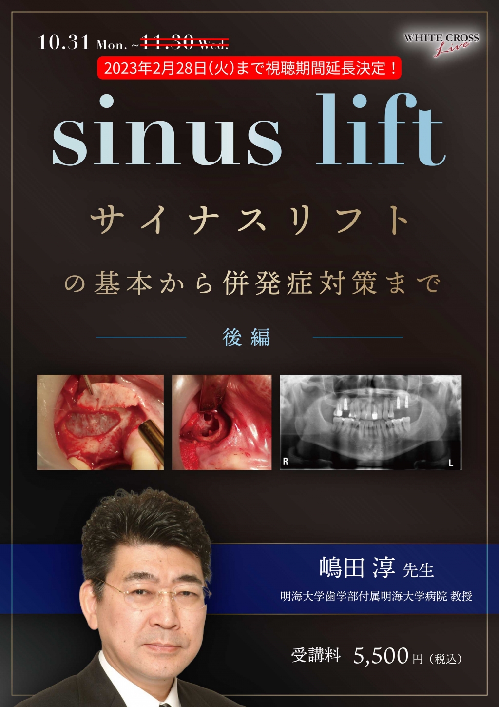 VOD］サイナスリフトの基本から併発症対策まで 〜後編〜 | WHITE CROSS