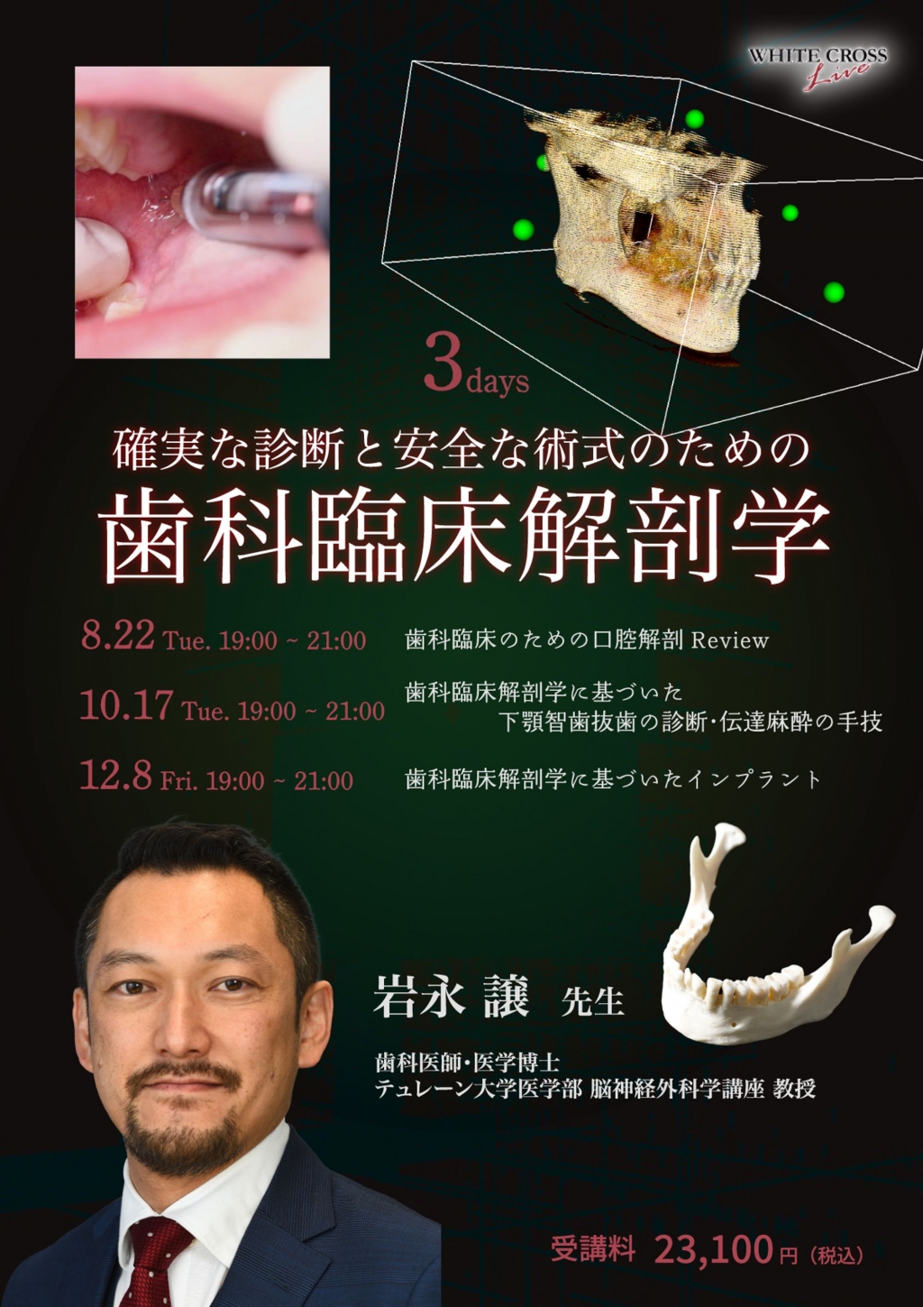 【裁断済】アナトミー 2 インプラント臨床のための解剖 アナトミー2: もう一度確認したいインプラント臨床のための解剖