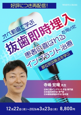 抜歯即時埋入を用いた患者に喜ばれるインプラント治療【再配信】の画像です。