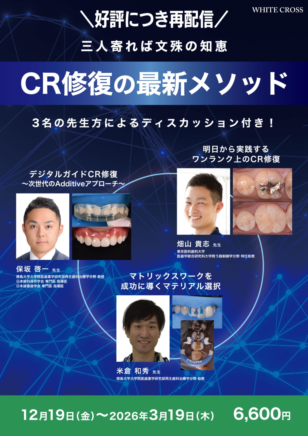 三人寄れば文殊の知恵！CR修復の最新メソッド【再配信】 | WHITE CROSS