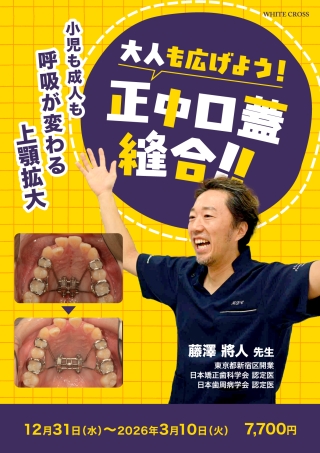 大人も広げよう！正中口蓋縫合！！の画像です。