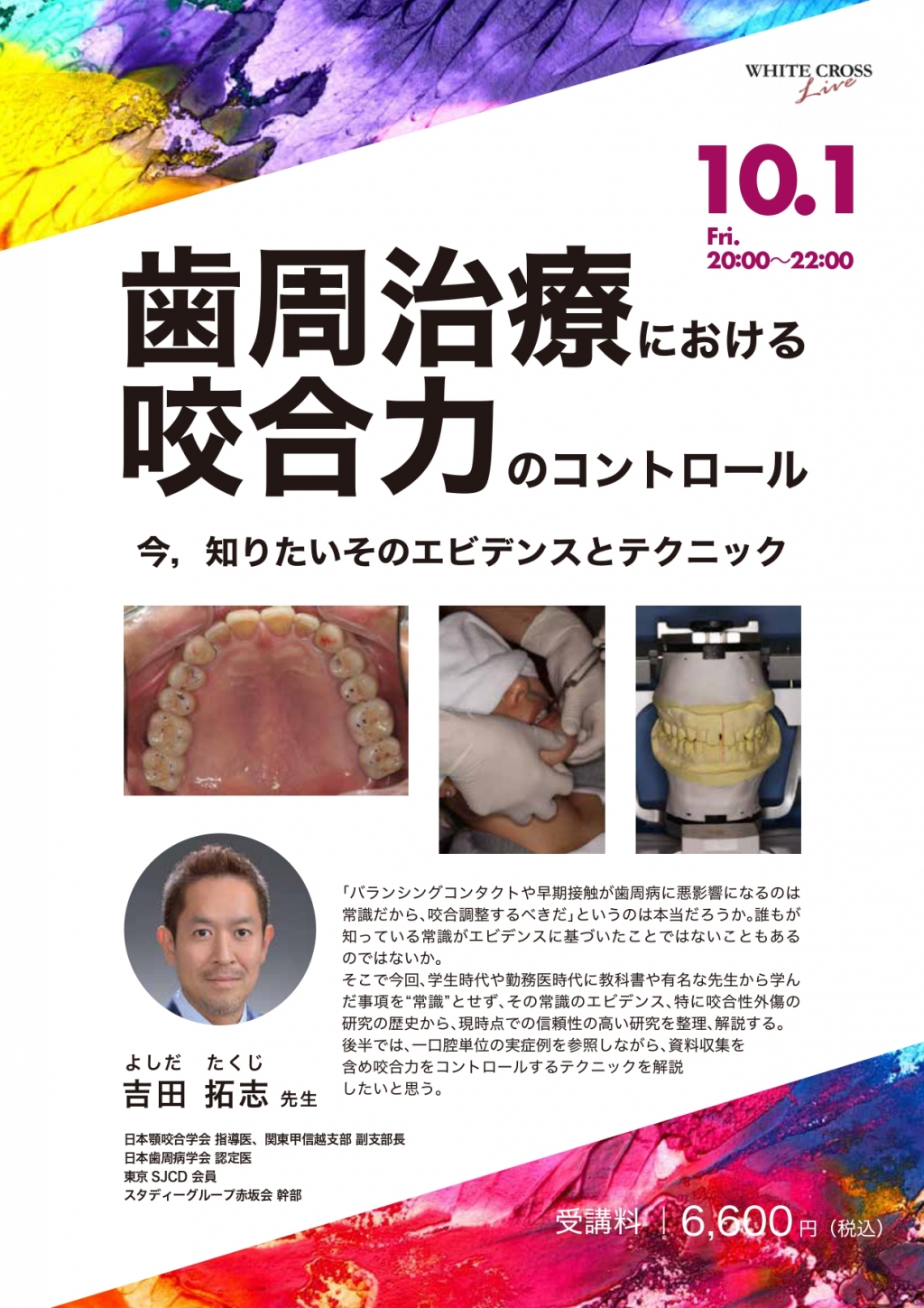 録画配信］歯周治療における咬合力のコントロール | WHITE CROSS