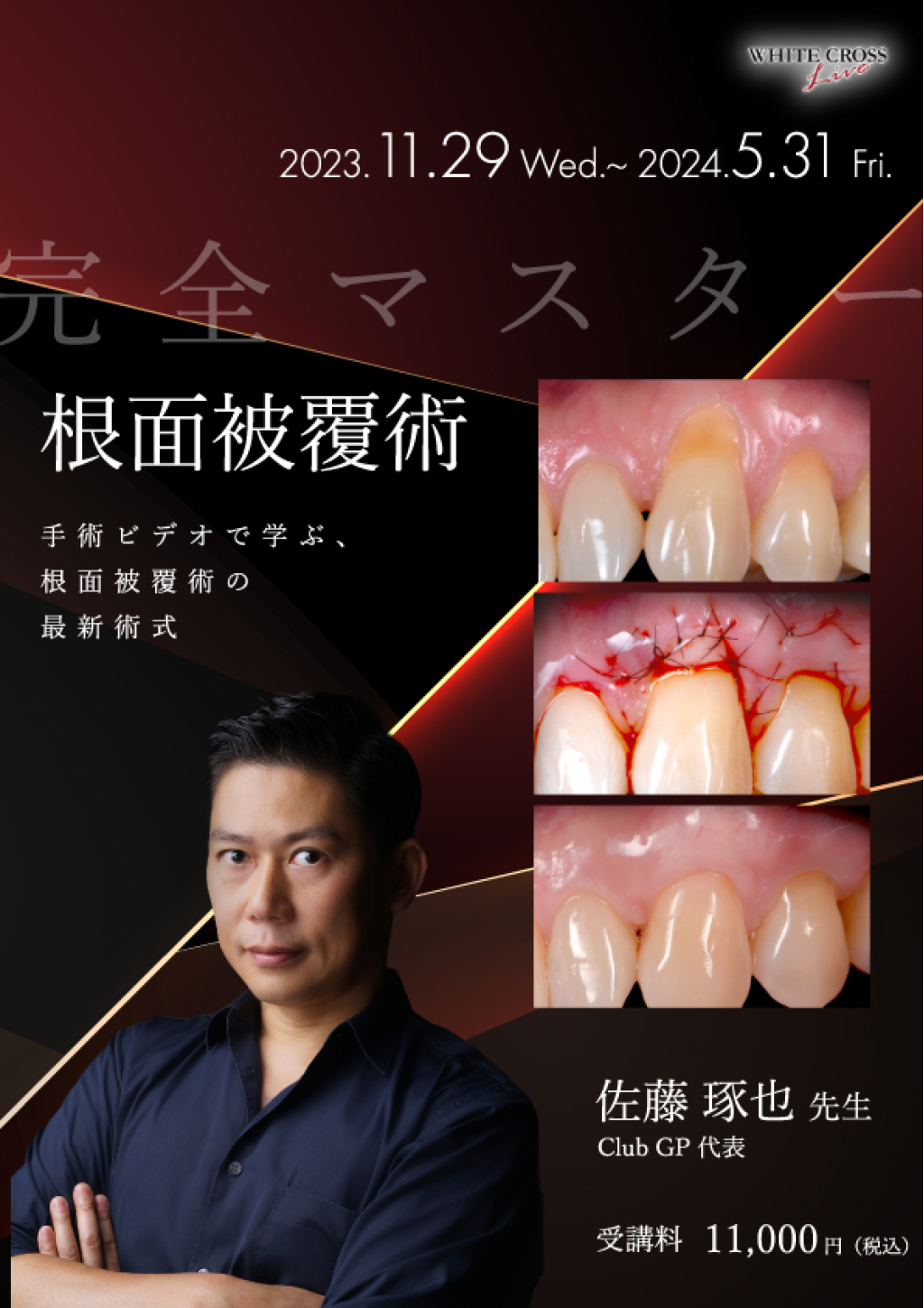 【極美品】これ1冊で両方学べる! 歯周組織再生療法&根面被覆術 51p2iV10WML.jpg_BO30,255,255,