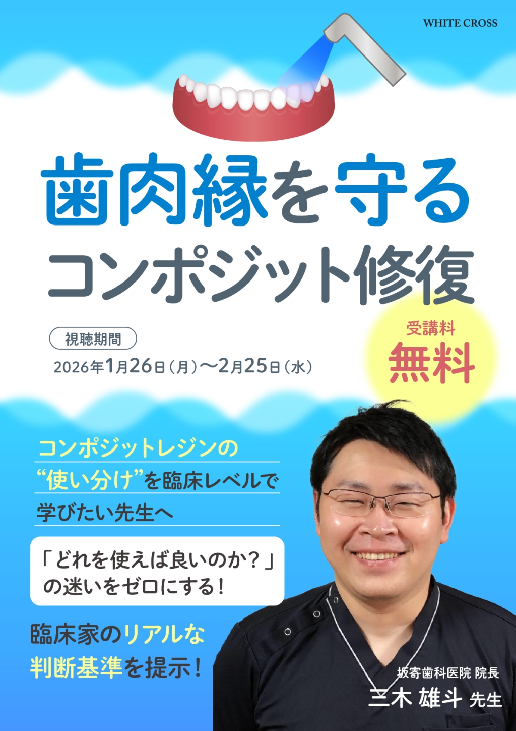 歯肉縁を守るコンポジット修復の画像です。