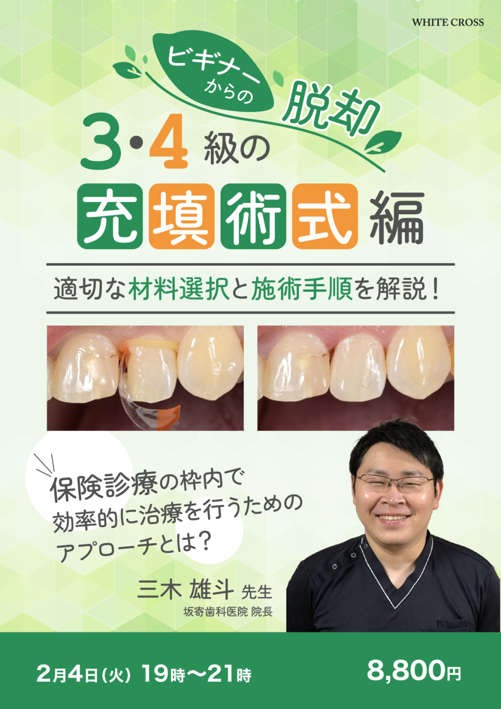 録画配信］ビギナーからの脱却 3・4級の充填術式編 | WHITE CROSS