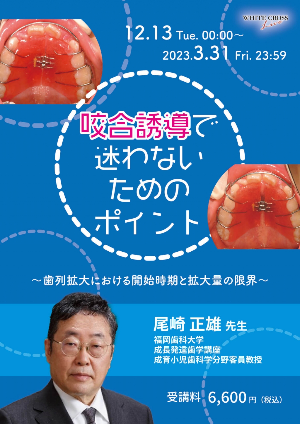 新 咬合論&咬合誘導論 : 新 犬歯誘導の起源:生涯にわたる咬合管理 新 咬合論&咬合誘導論: 新 犬歯誘導の起源:生涯にわたる咬合管理