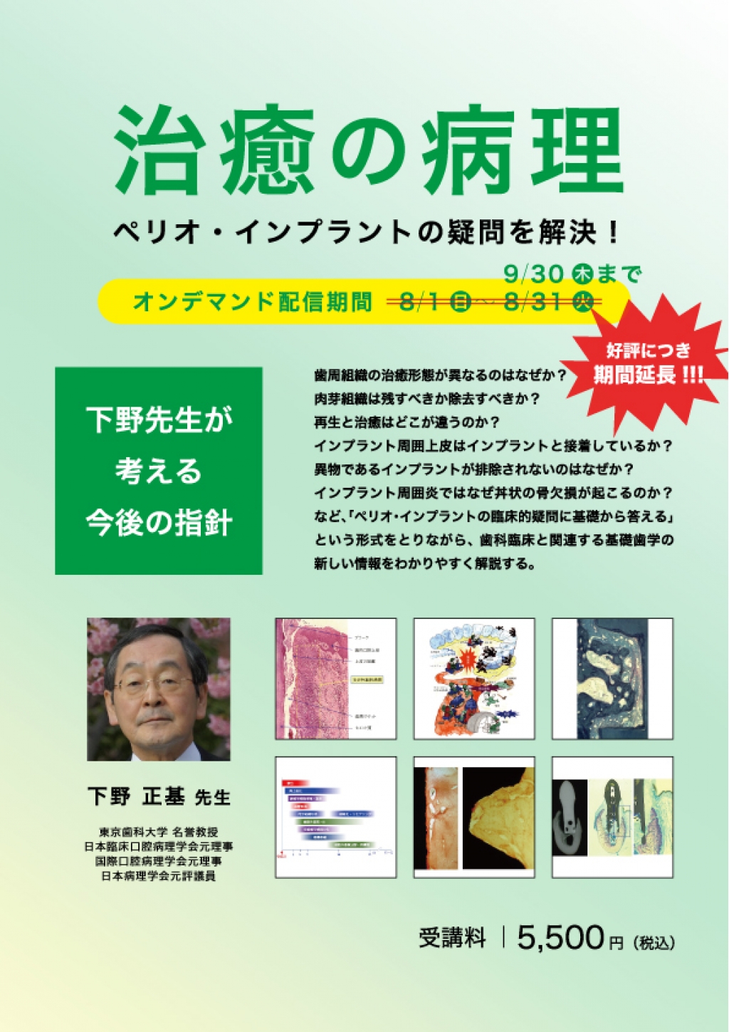 Web］治癒の病理 ペリオ・インプラントの疑問を解決！～下野先生が