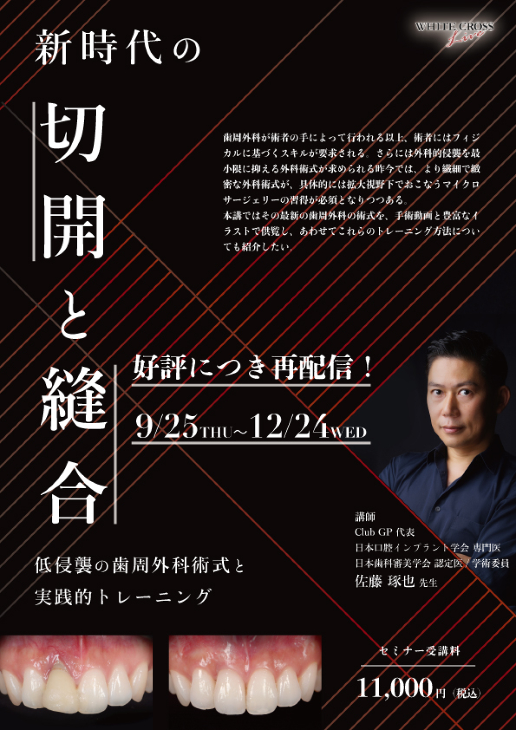 新時代の切開と縫合【再配信】 | WHITE CROSS
