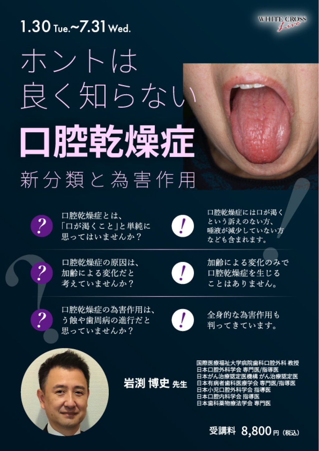 VOD］ホントは良く知らない口腔乾燥症 新分類と為害作用 | WHITE