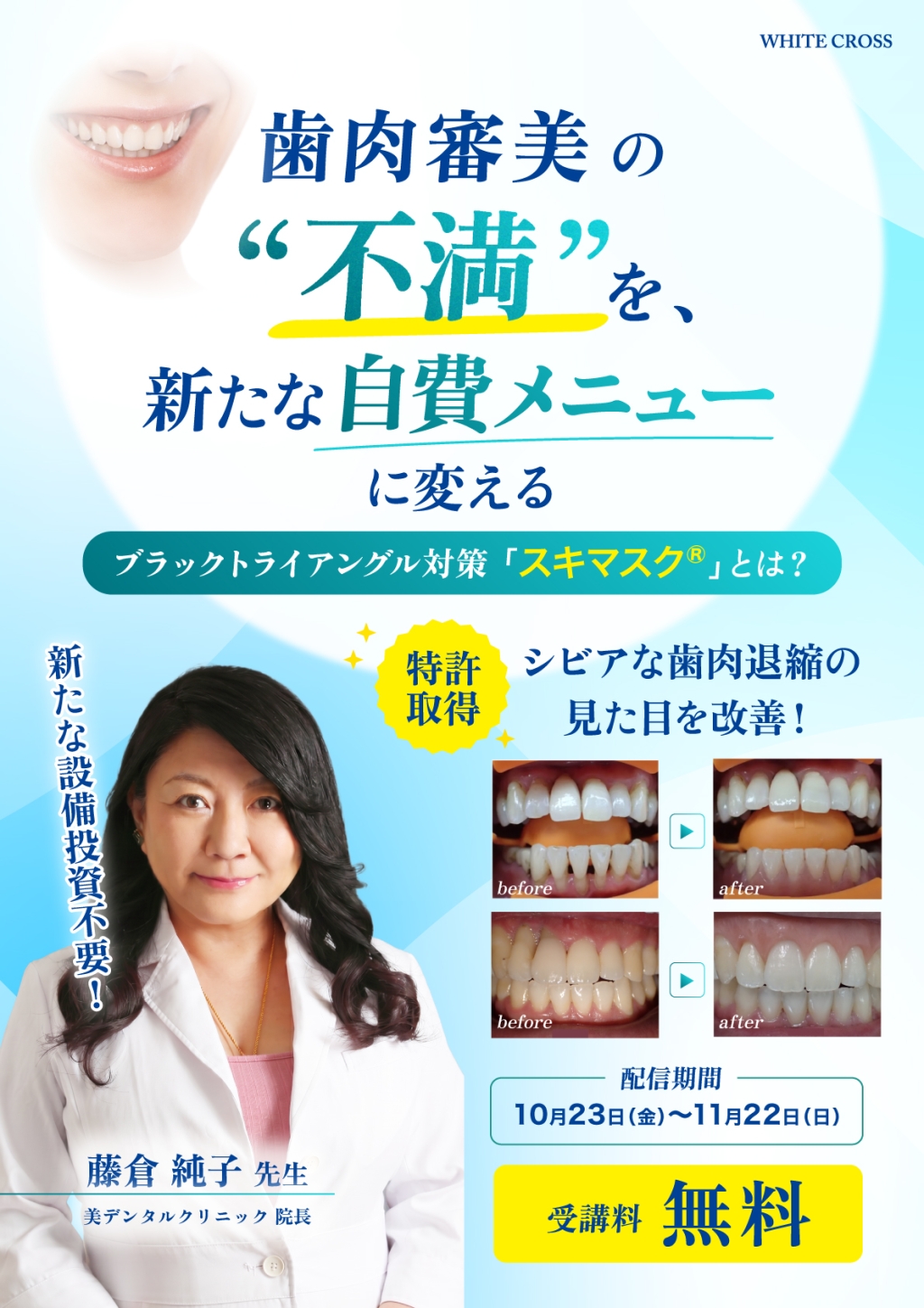 歯肉審美の“不満”を、新たな自費メニューに変える〜ブラック
