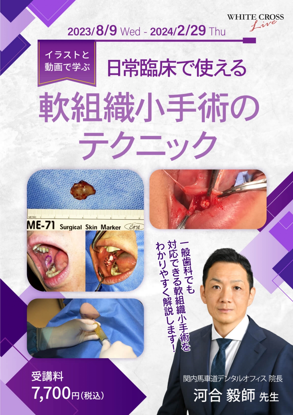 歯科臨床講座シリーズ VOD］〜イラストと動画で学ぶ〜日常臨床で使える軟組織小手術の