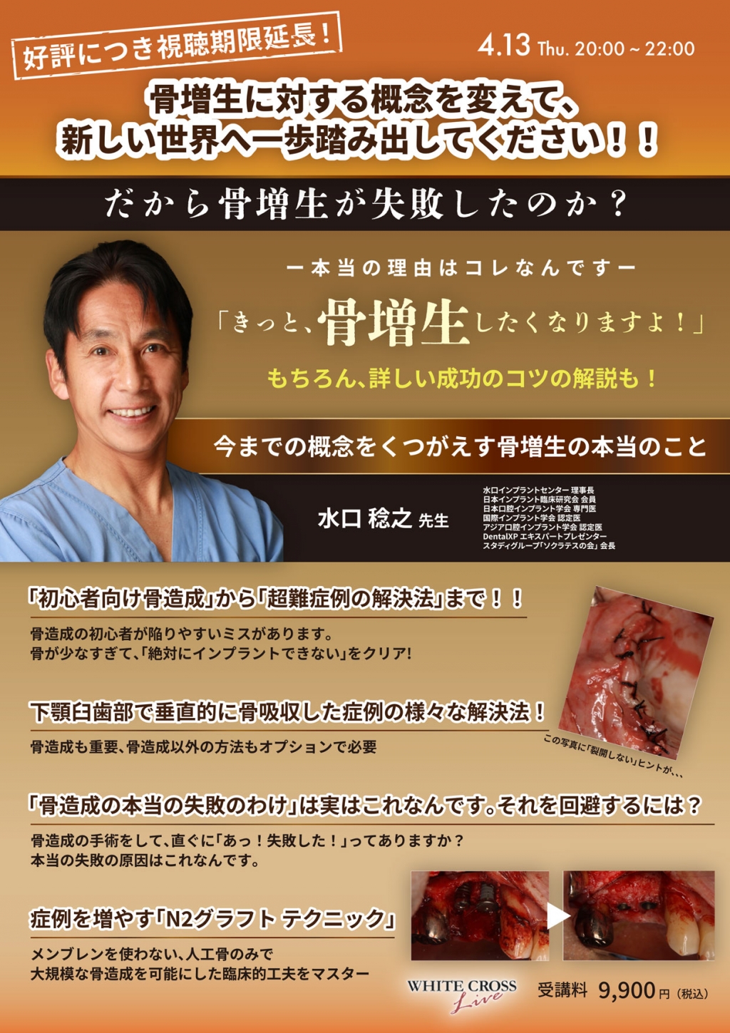 録画配信］骨増生に対する概念を変えて、新しい世界へ一歩