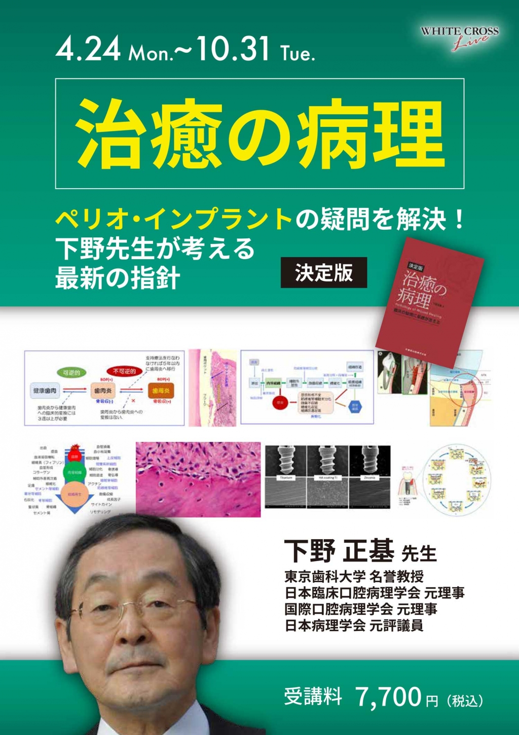 VOD］治癒の病理 ペリオ・インプラントの疑問を解決！下野先生が考える