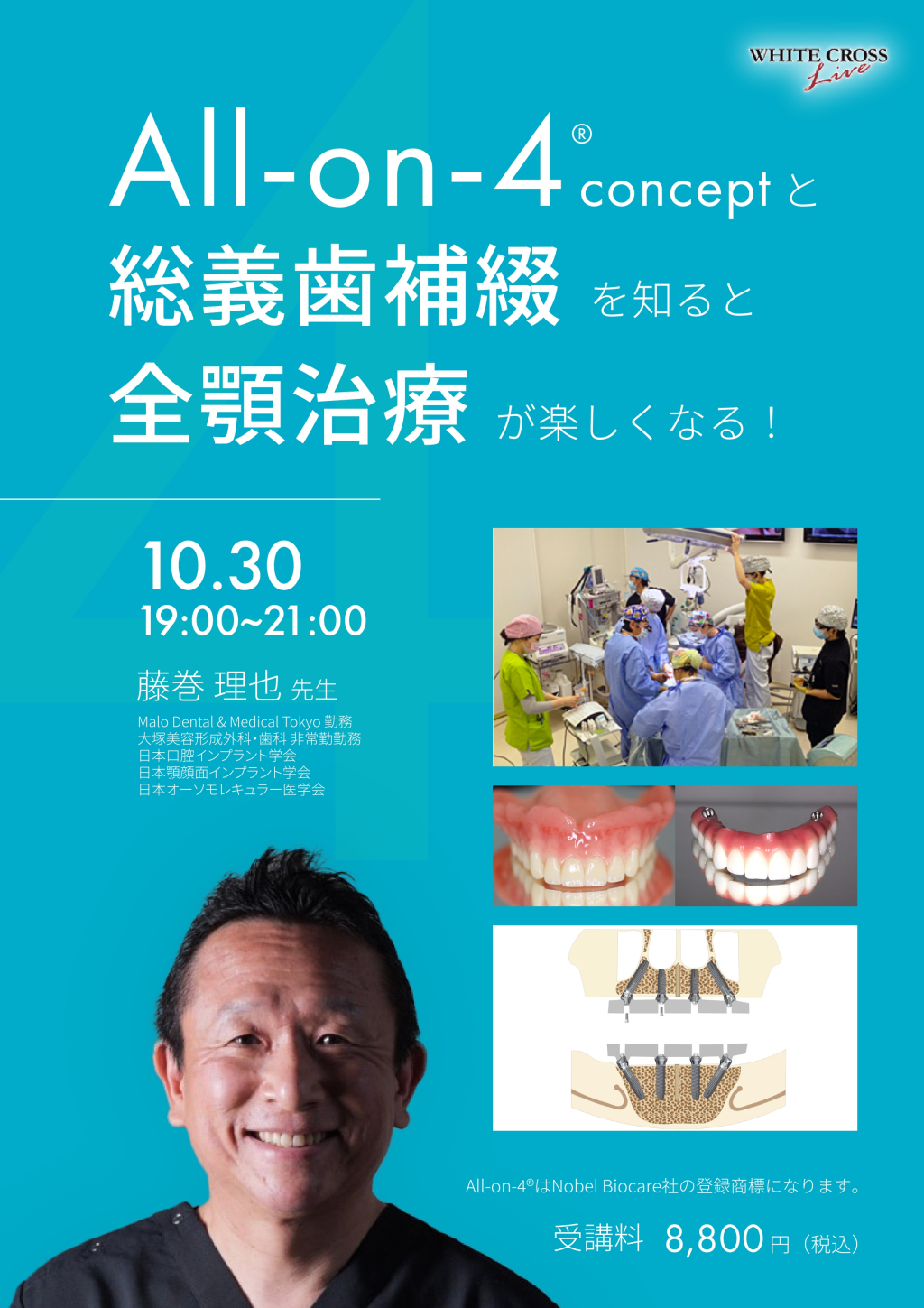 録画配信］All-on-4®️と総義歯補綴を知ると全顎治療が楽しくなる
