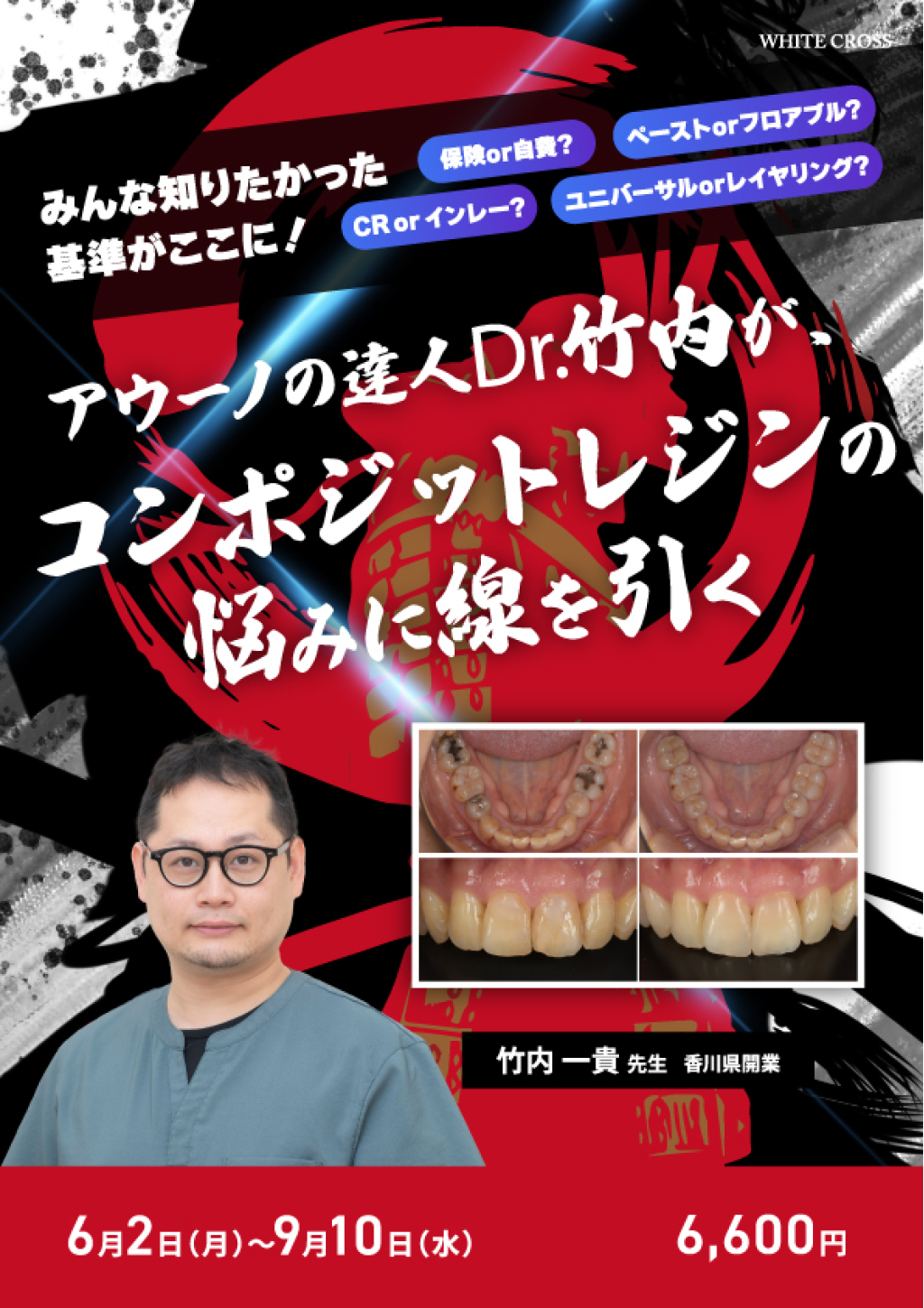 アウーノの達人Dr.竹内が、コンポジットレジンの悩みに線を引くの画像です。