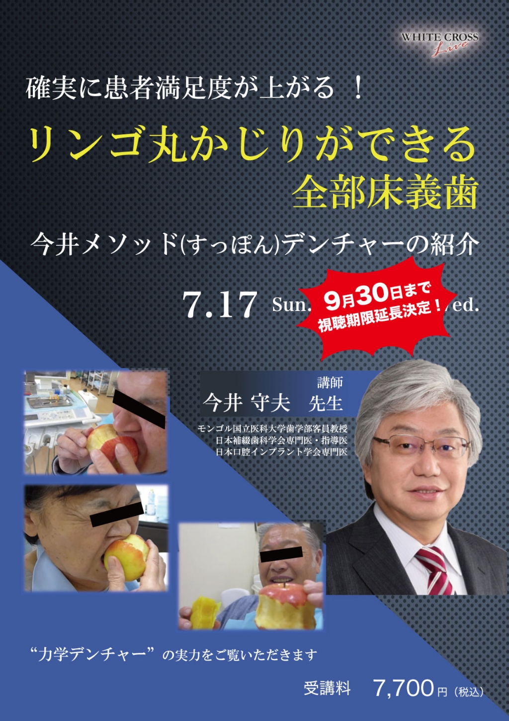 VOD］確実に患者満足度が上がる！ “リンゴ丸かじりができる” 全部床