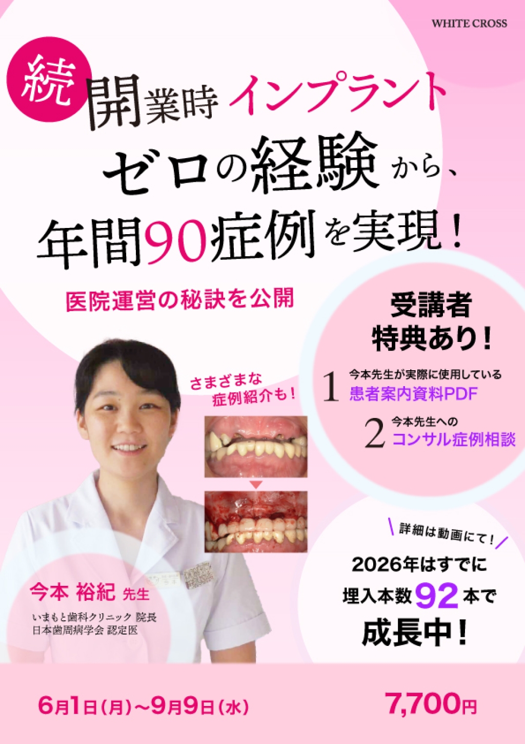 続】開業時インプラントゼロの経験から、年間90症例を実現！医院運営の