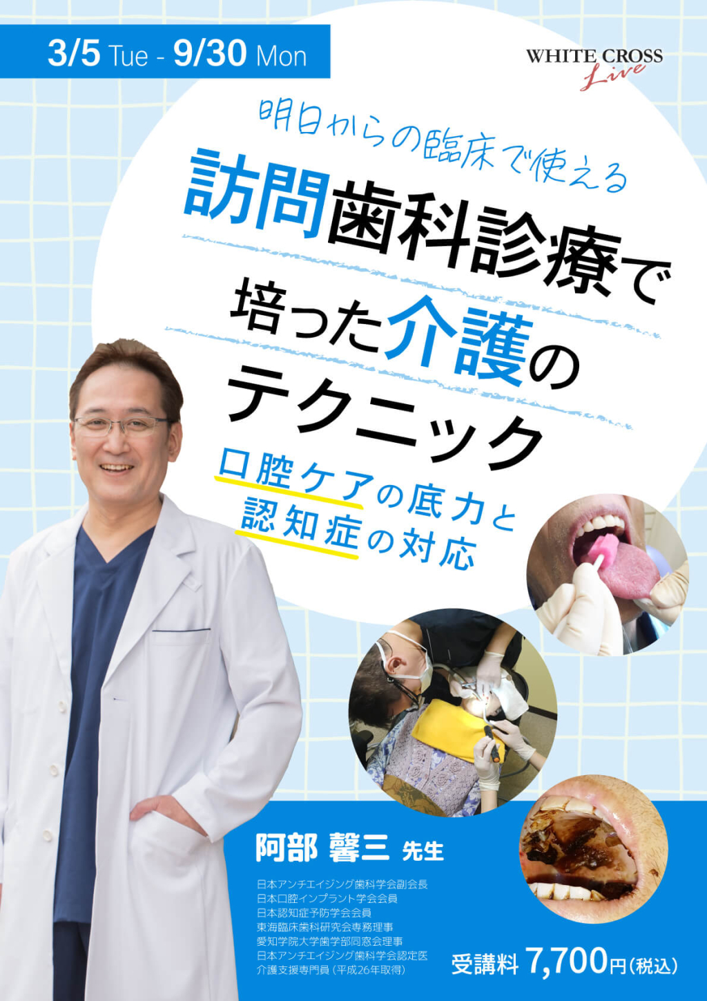 訪問歯科診療 食介護の知識と実践 VOD］訪問歯科診療で培った介護のテクニック～口腔ケアの底力と認知症