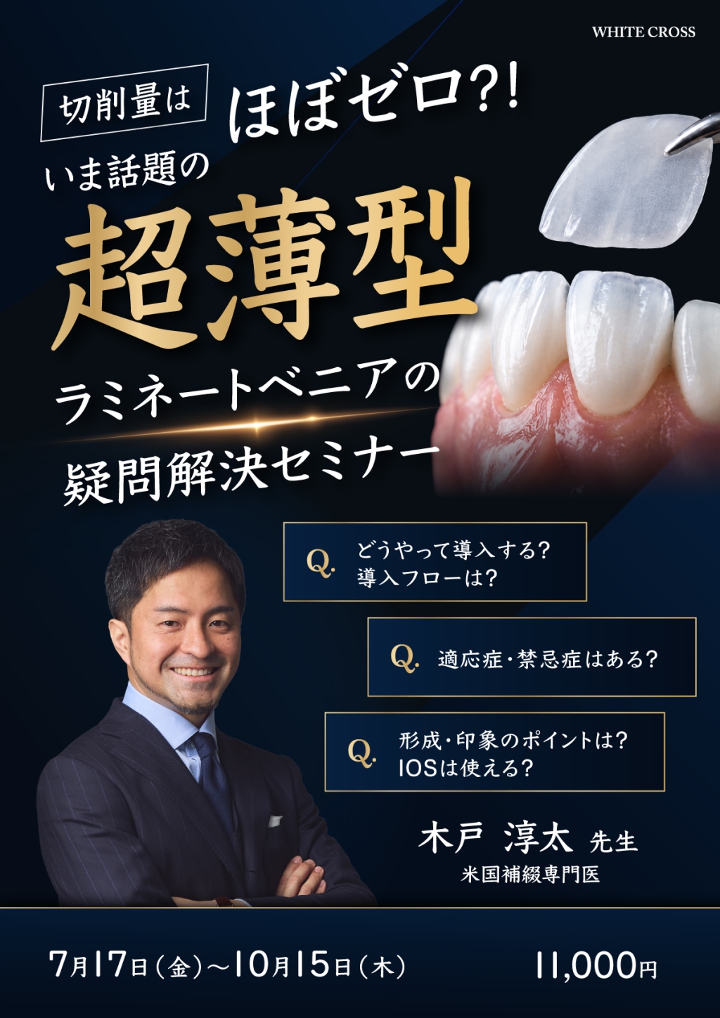 切削量はほぼゼロ？！いま話題の超薄型ラミネートベニアの疑問解決