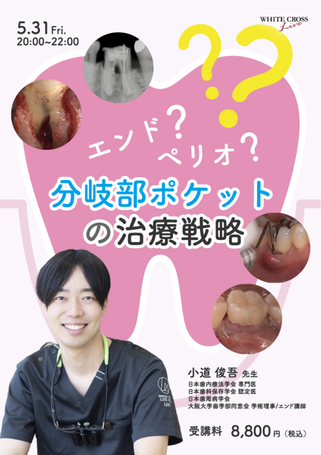 基礎と臨床がつながる歯周解剖 歯周病専門医が語る\"目からウロコ\"のペリオ&イン… 基礎と臨床がつながる歯周解剖 | 牧草 一人 |本 | 通販 | Amazon