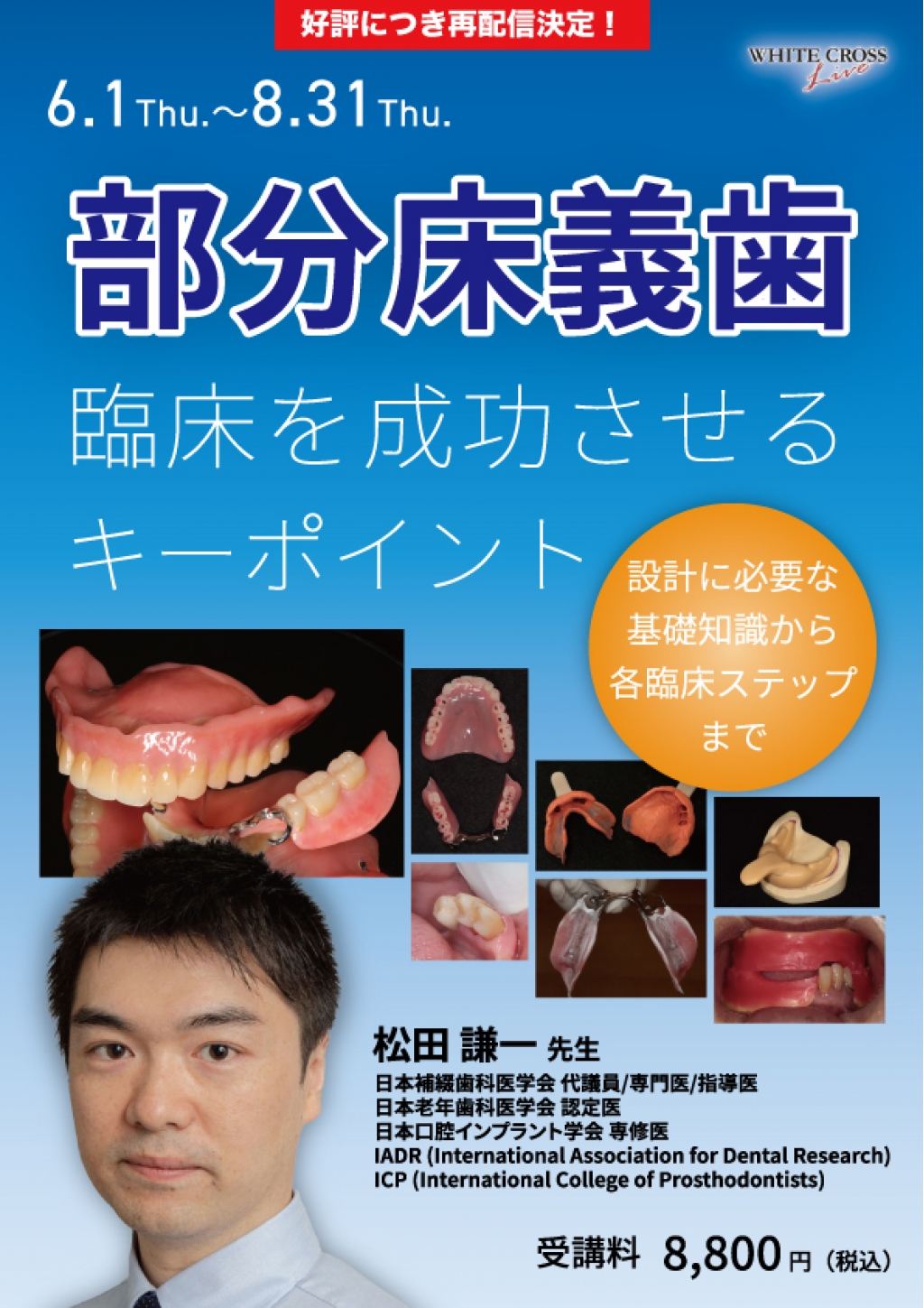 Key Sentence Dentist 2026 基礎POINT講座 VOD］部分床義歯臨床を成功させるキーポイント【再配信】 | WHITE CROSS