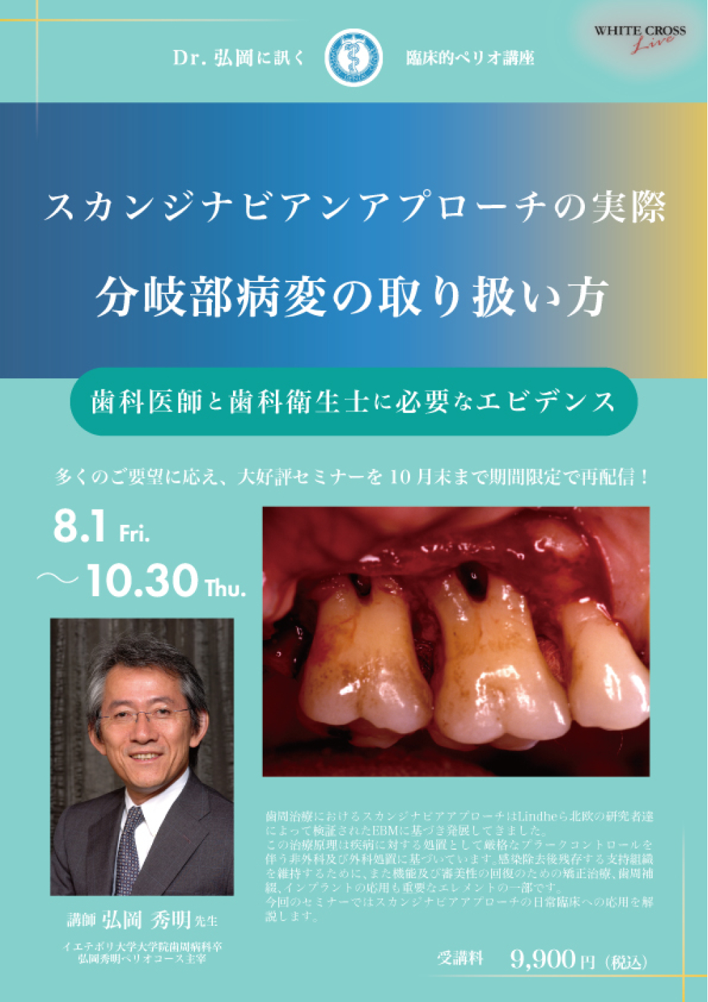【まりもページ】組織病理アトラス、歯科麻酔学、無歯顎補綴治療学 無歯顎補綴治療学 第4版 | 市川 哲雄, 大川 周治, 大久保 力廣