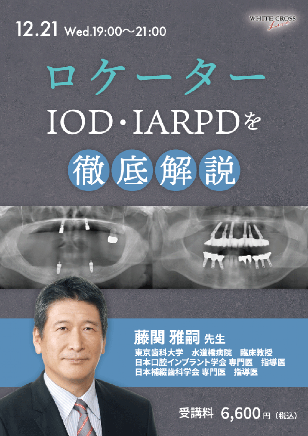 送料無料/DVD4枚■インプラント戦略的集患・増収セミナー /歯科経営/集客 歯科医院さま向け無料WEBセミナー開催】先進のAI技術で、歯科