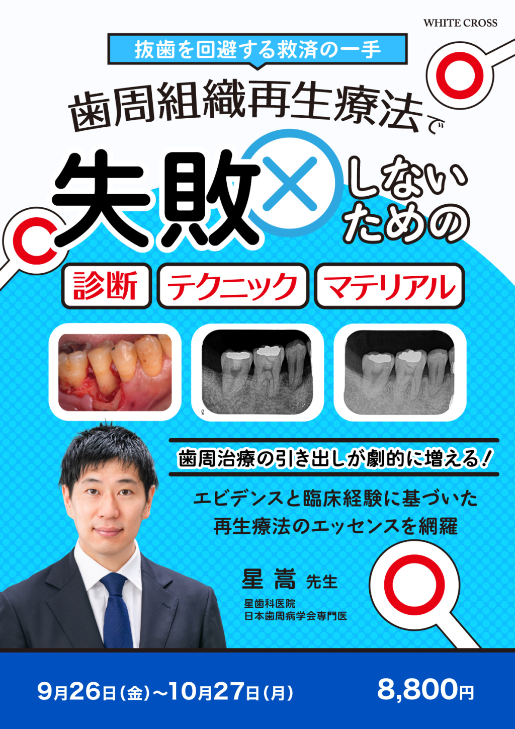 【裁断済】歯周再生療法を成功させるテクニックとストラテジー 歯周再生療法を成功させるテクニックとストラテジー