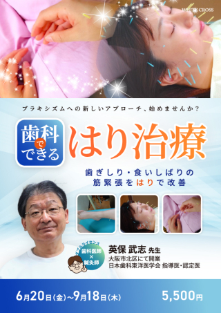 歯科でできるはり治療〜歯ぎしり・食いしばりの筋緊張をはりで改善〜の画像です。