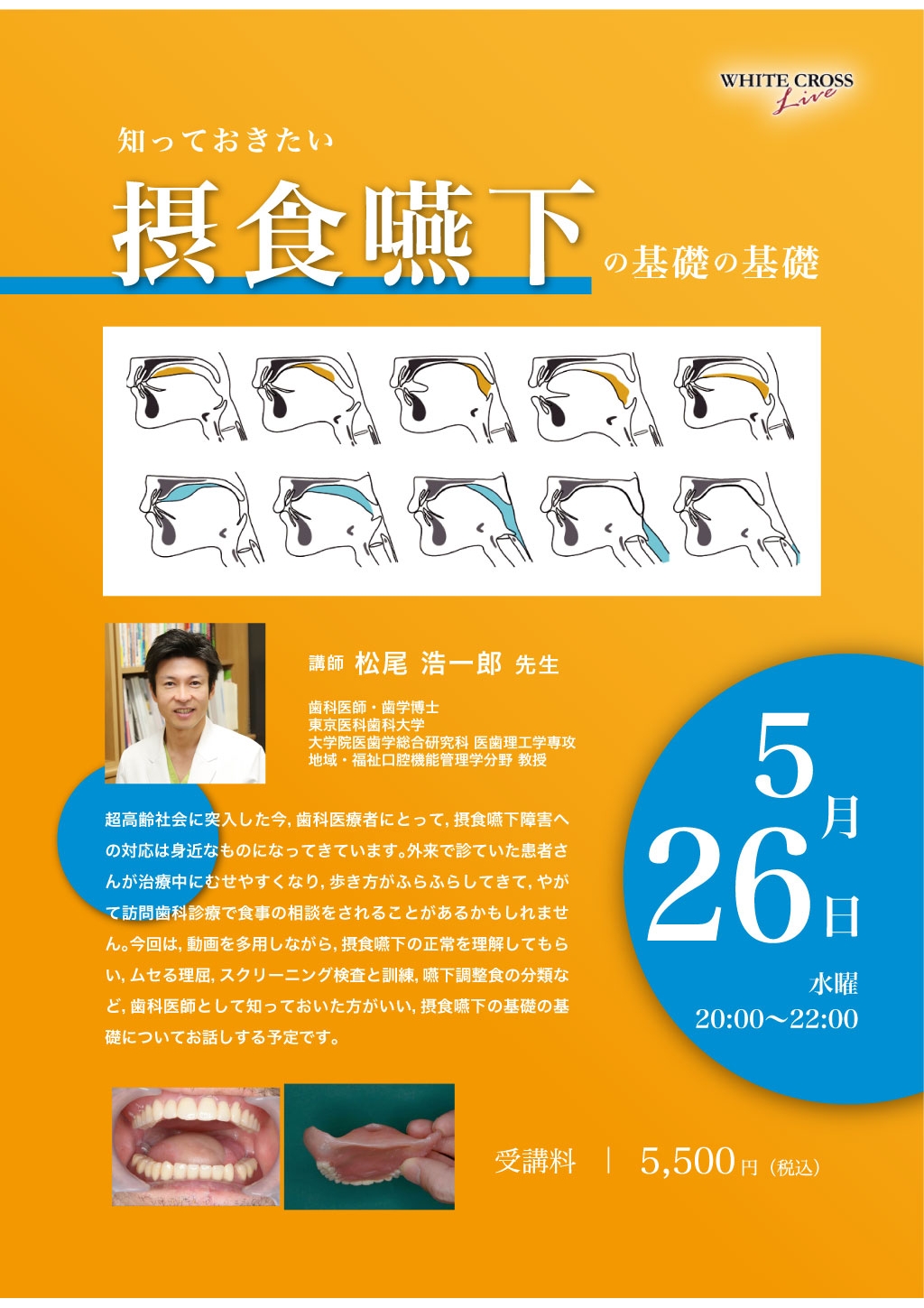 録画配信］知っておきたい摂食嚥下の基礎の基礎 | WHITE CROSS