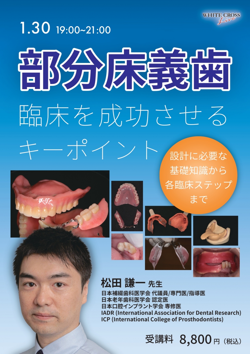 録画配信］部分床義歯臨床を成功させるキーポイント | WHITE CROSS