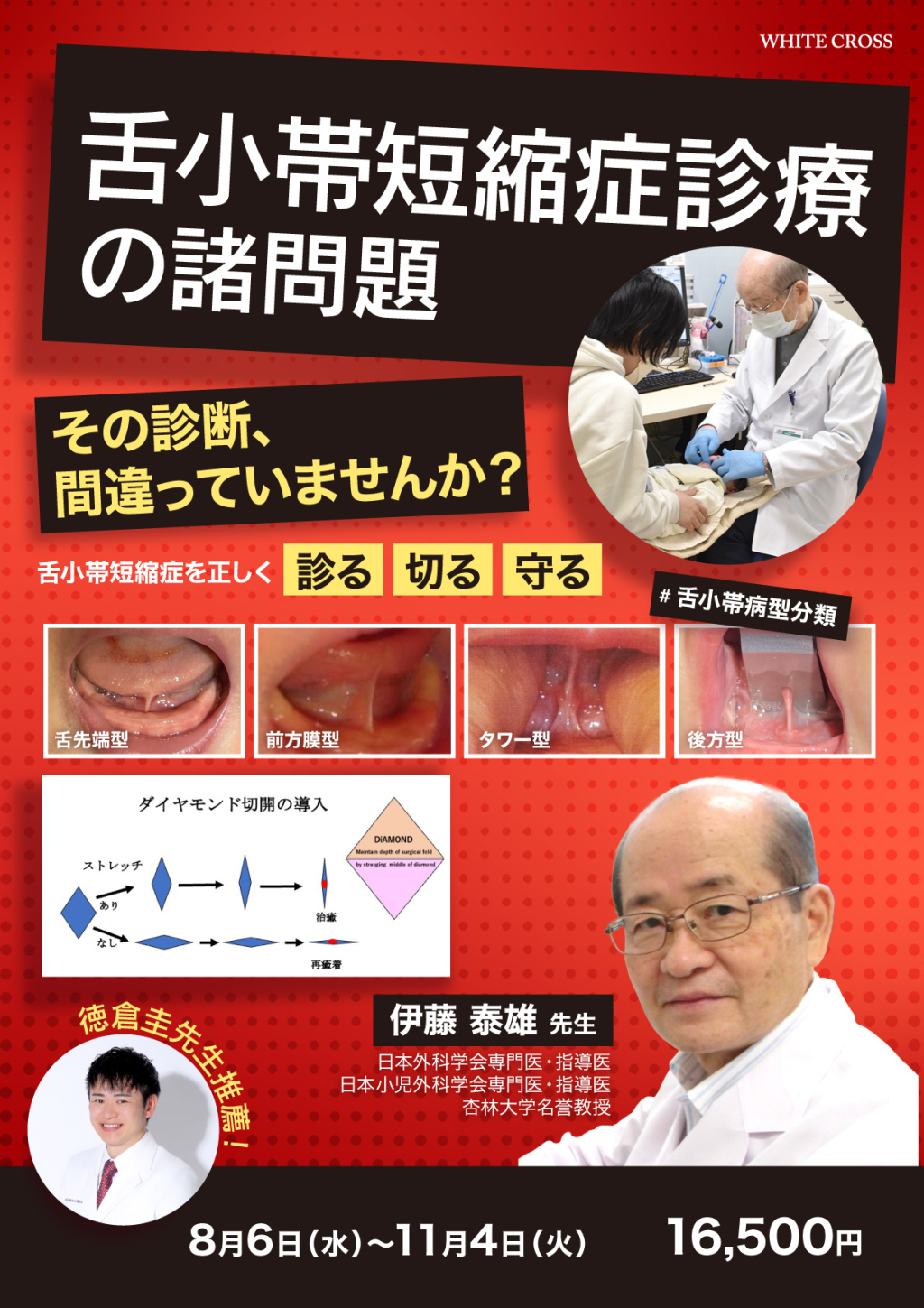 舌診論 舌診論［改訂増補版］ 新・臨床中医学 舌診篇 | 陳 勇 |本