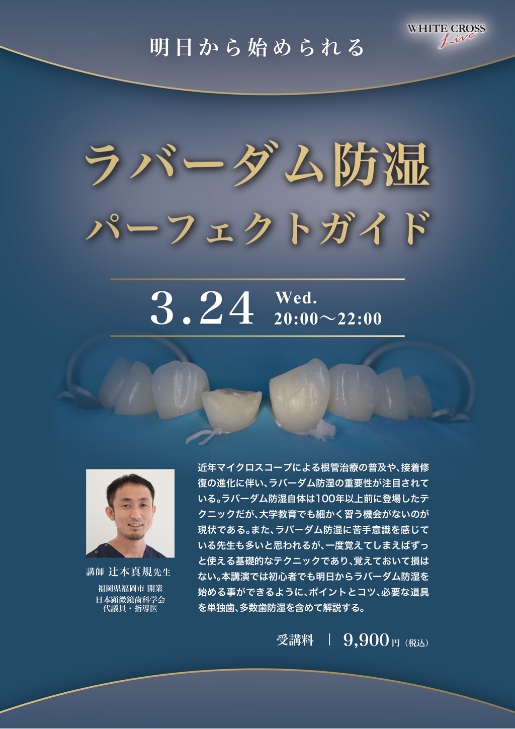 録画配信］明日から始められるラバーダム防湿 パーフェクト