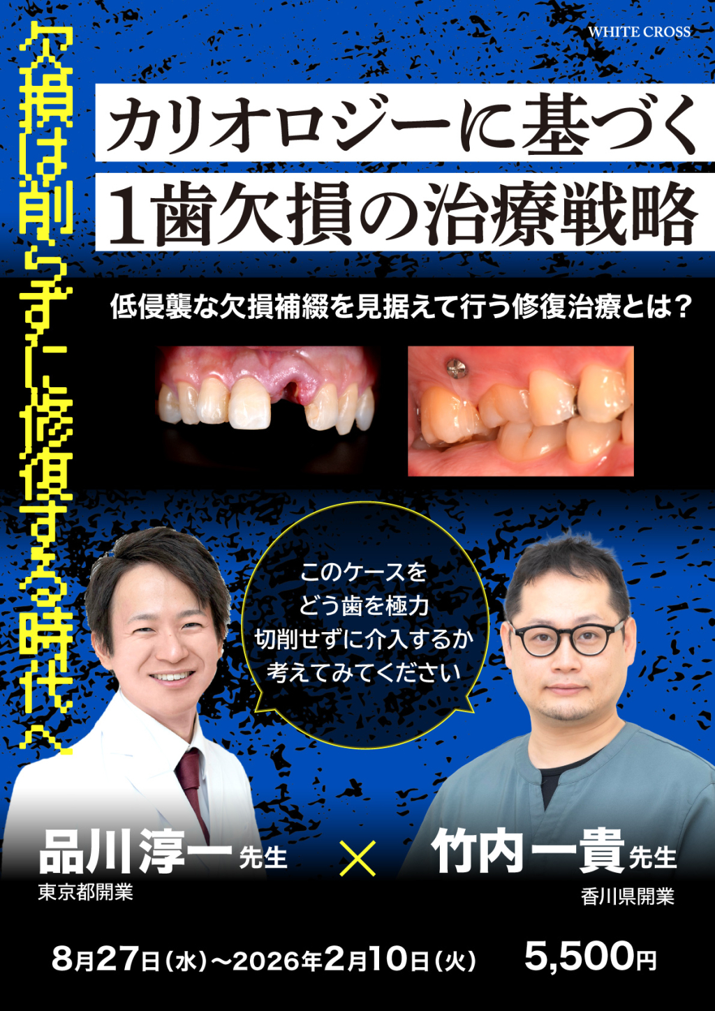 裁断済み　ペリオの臨床戦略を学ぶ歯周動的治療 ペリオの臨床戦略を学ぶ歯周動的治療 健康・医学