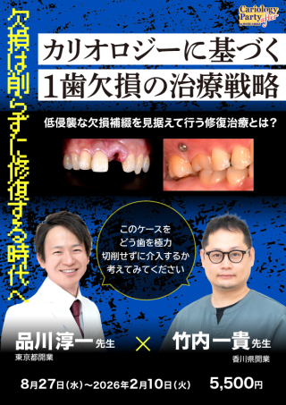 カリオロジーに基づく1歯欠損の治療戦略の画像です。
