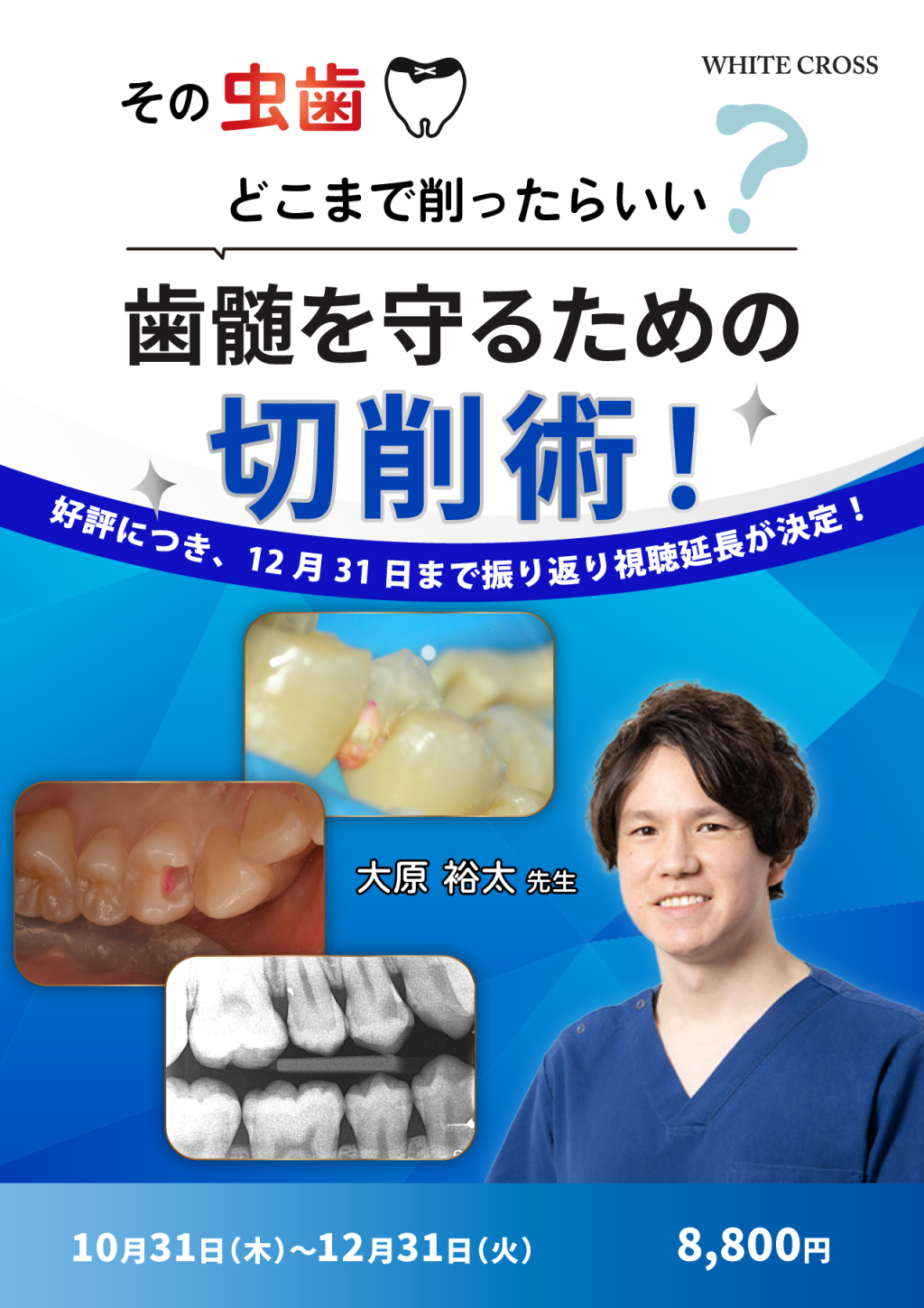 ⚠裁断済　歯周外科を始めるために知っておきたい10のこと 歯周外科を始めるために知っておきたい10のこと/医歯薬出版株式会社