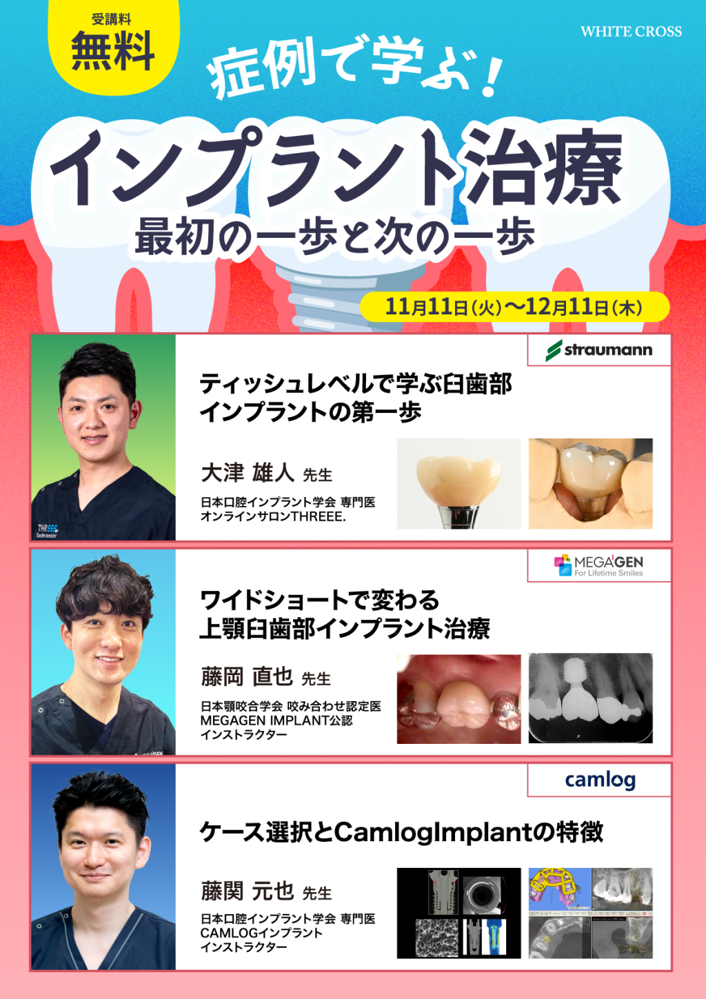 症例で学ぶ！インプラント治療、最初の一歩と次の一歩 | WHITE CROSS