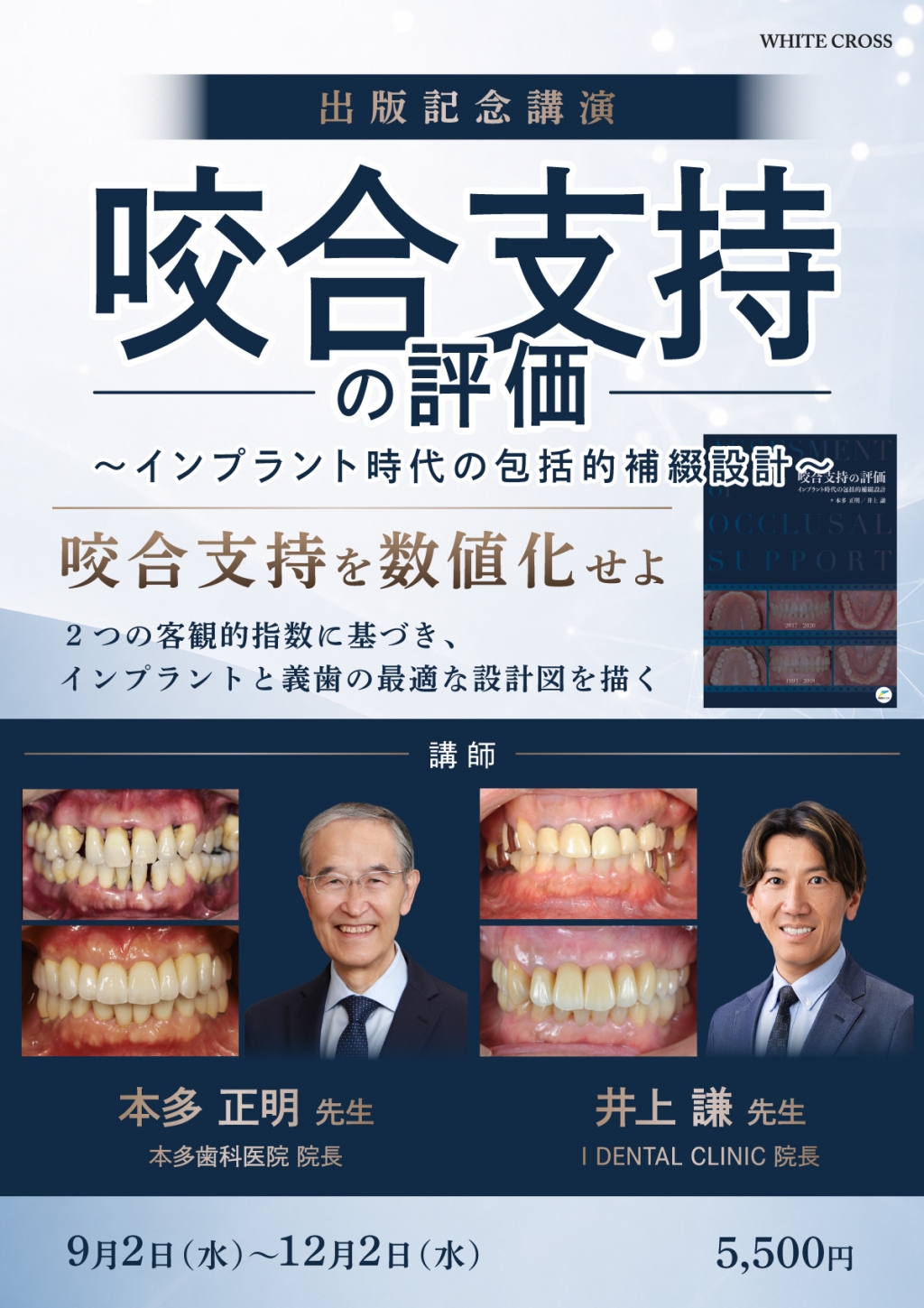 咬合支持の評価〜インプラント時代の包括的補綴設計〜 | WHITE CROSS