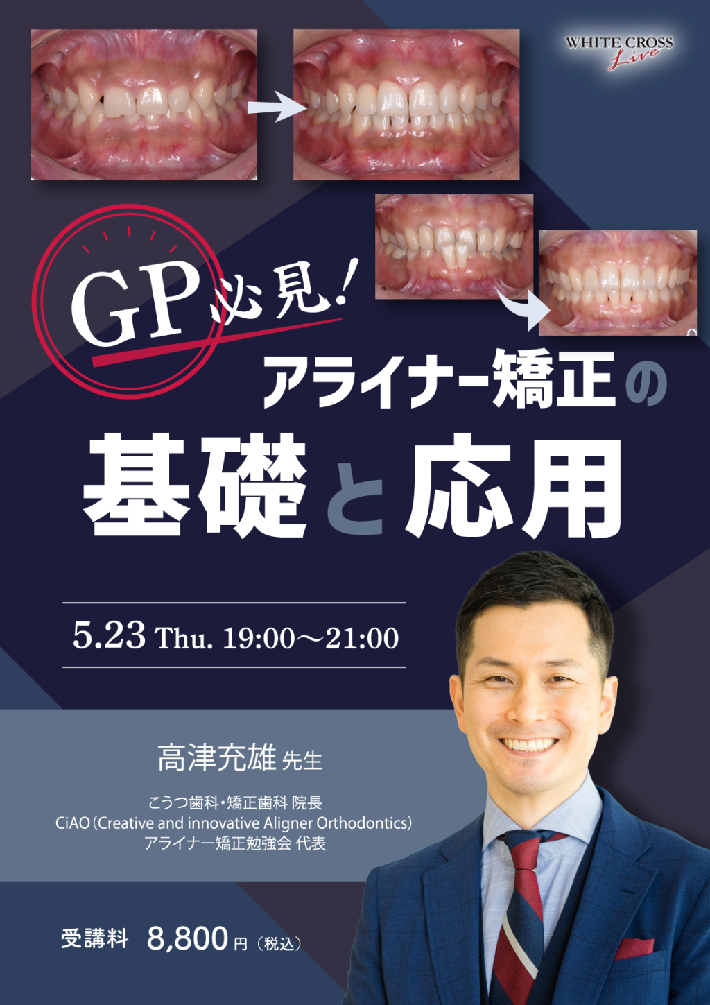 録画配信］GP必見！アライナー矯正の基礎と応用 | WHITE CROSS
