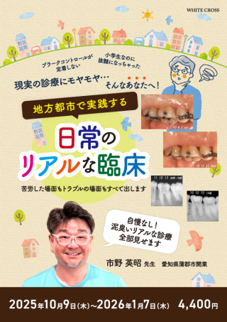 【裁断済】Dr.弘岡に訊く臨床的ペリオ講座 スカンジナビアンアプローチの実践 Dr.弘岡に訊く臨床的ペリオ講座 スカンジナビアンアプローチの