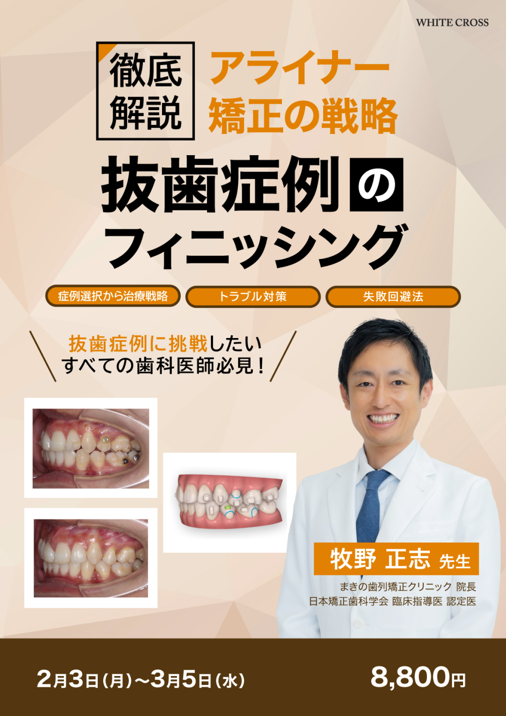 アライナー矯正歯科治療 CLEAR ALIGNERTECHNIQUE : Sandra Tai | HMV&BOOKS online -  9784781207537