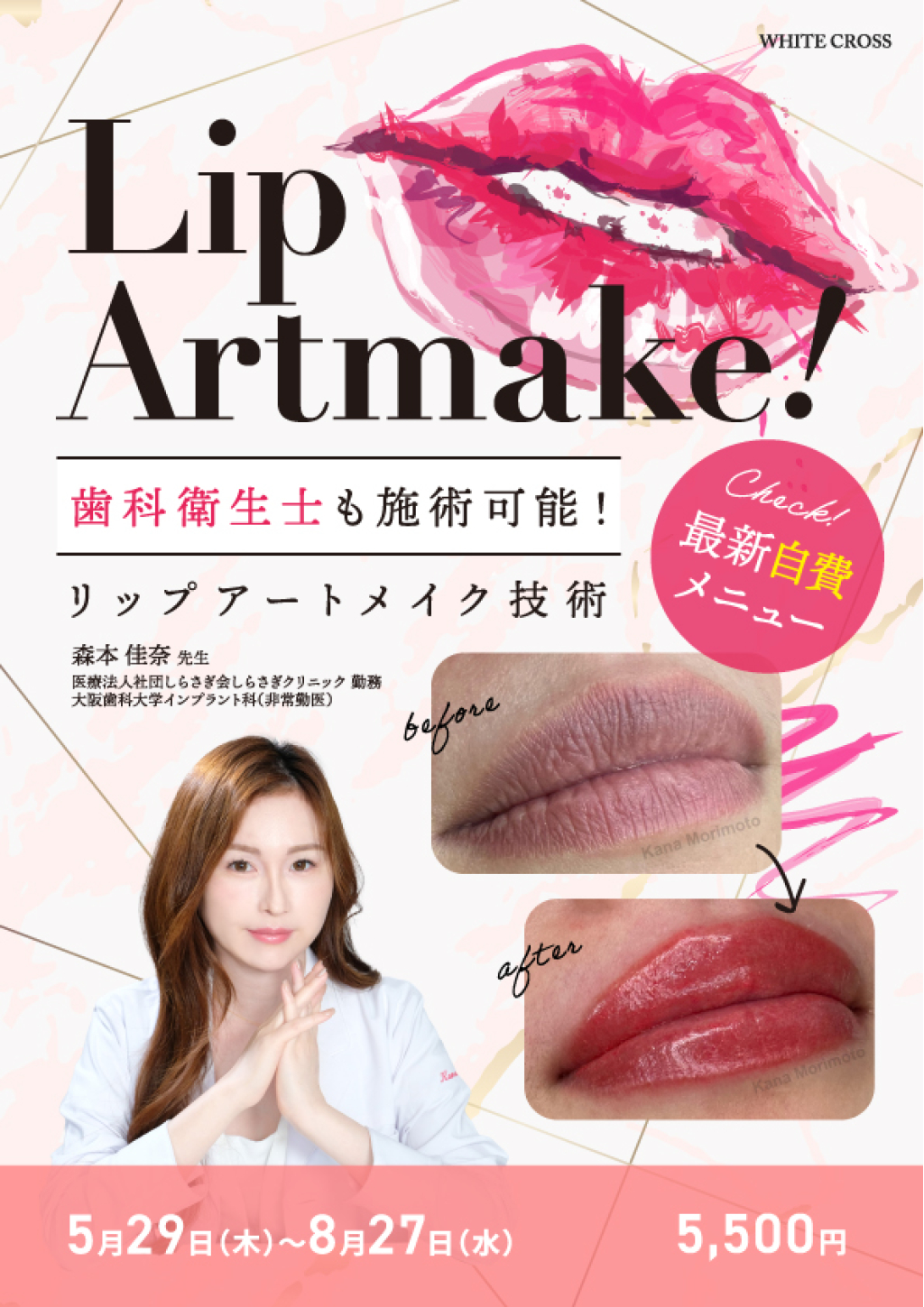 歯科衛生士も施術可能！最新自費メニュー「リップアートメイク技術